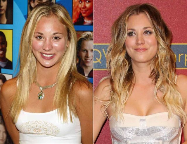 Kaley Cuoco, rinoplastía antes y después