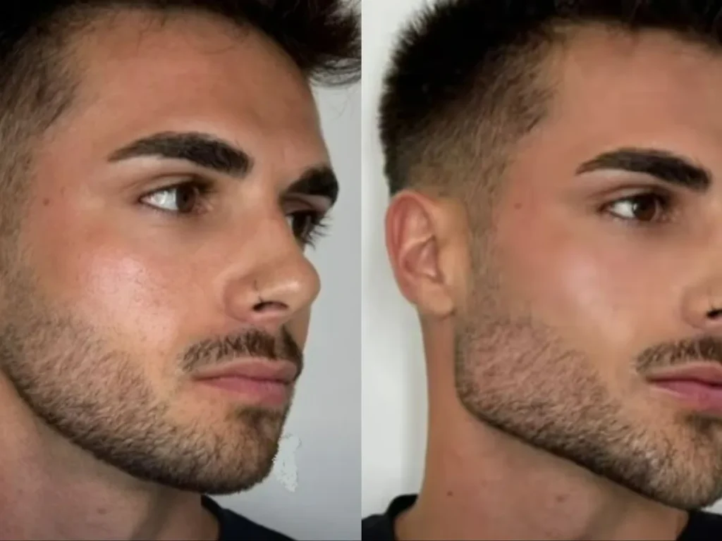 Cómo se ve la operación Rostro Diamante