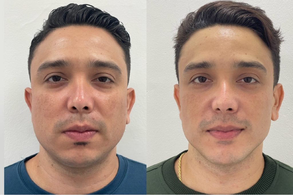 De qué trata la operación Rostro Diamante