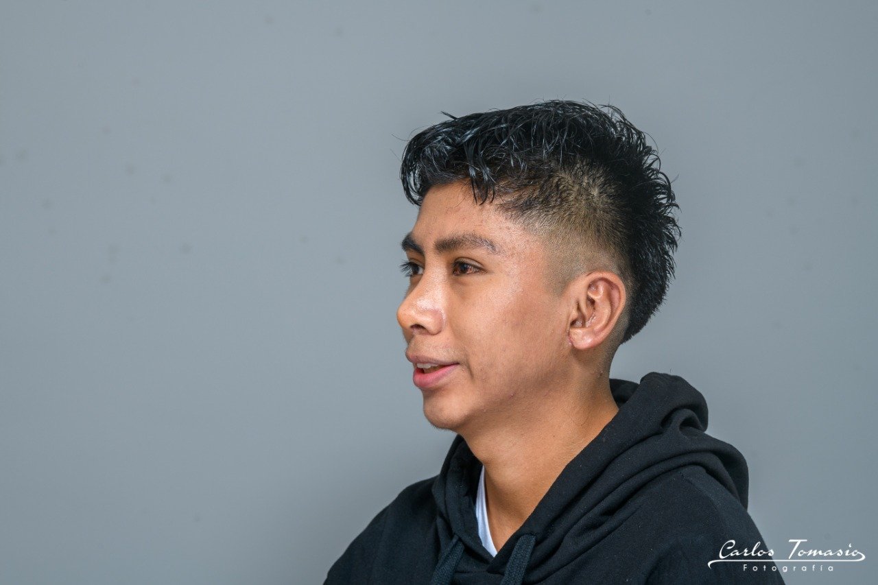 Rinoplastía para hombres en Perú