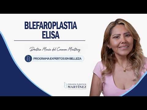 El Caso de Elisa: Antes y Después de una Blefaroplastia Superior e Inferior✨ — Cirugía Plástica Martínez