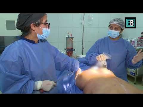 "¡Transforma Tu Cuerpo con BBL y Guía Ecográfica! Seguridad y Resultados Asombrosos" — Cirugía Plástica Martínez