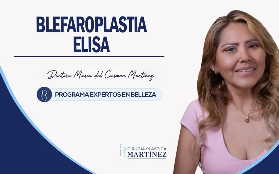 El caso de Elisa: blefaroplastia superior e inferior