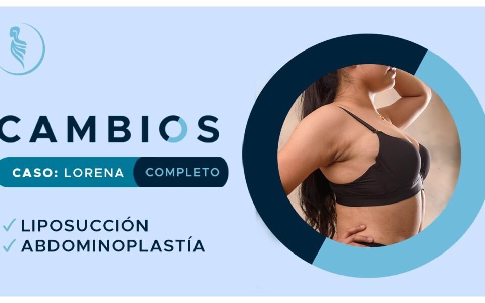 Programa Cambios: liposucción y abdominoplastia de Lorena
