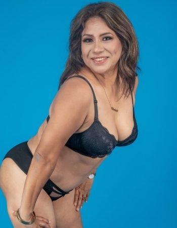 Después — Abdominoplastía