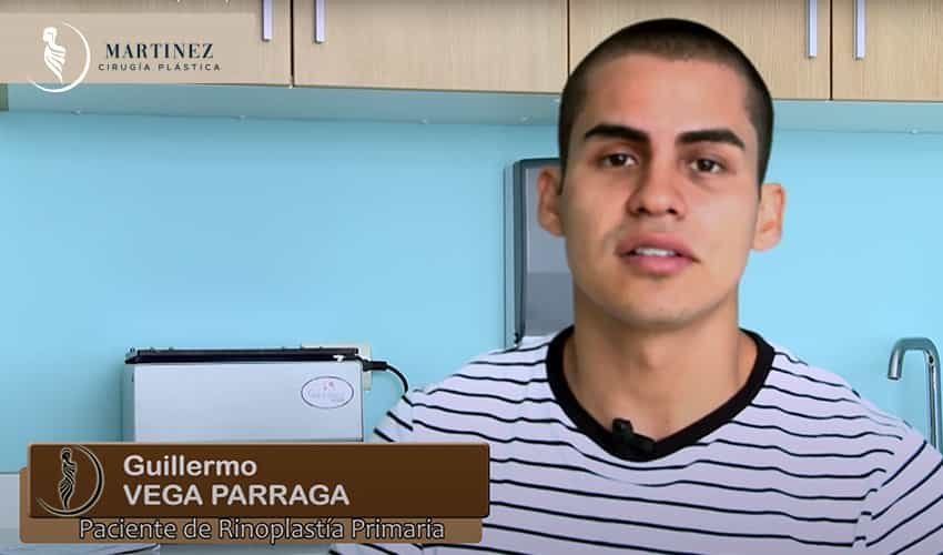 Rinoplastia Historia De Guillermo