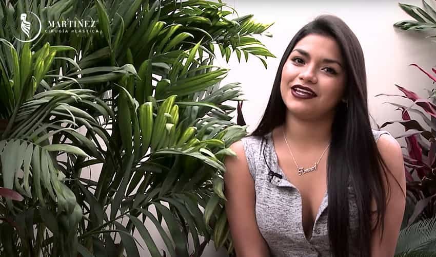 Rinoplastia Testimonio De Romina