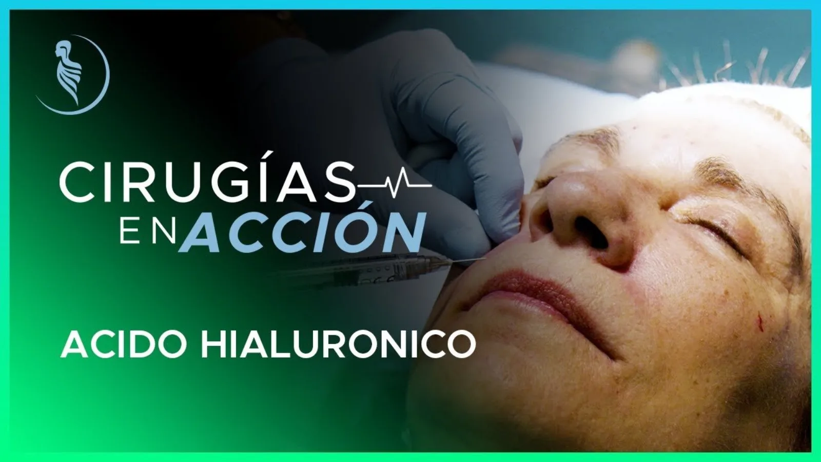 accion-11