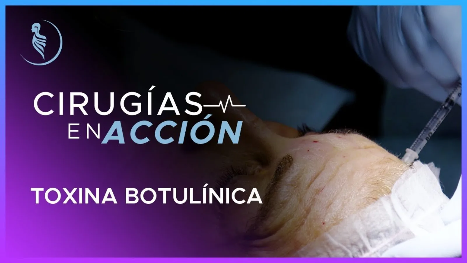 accion-13