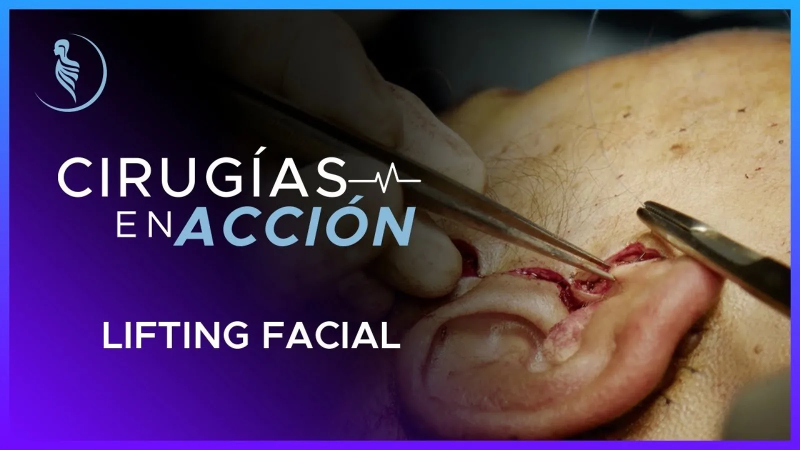accion-16