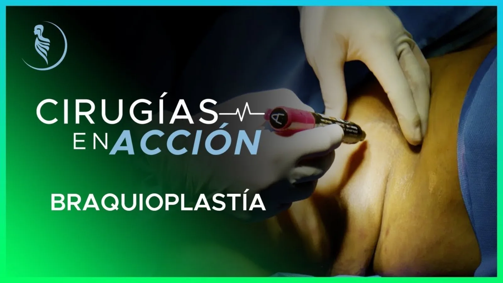accion-17