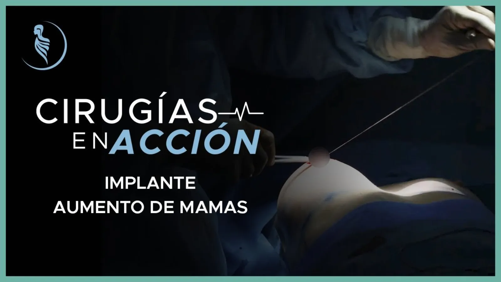 accion-2