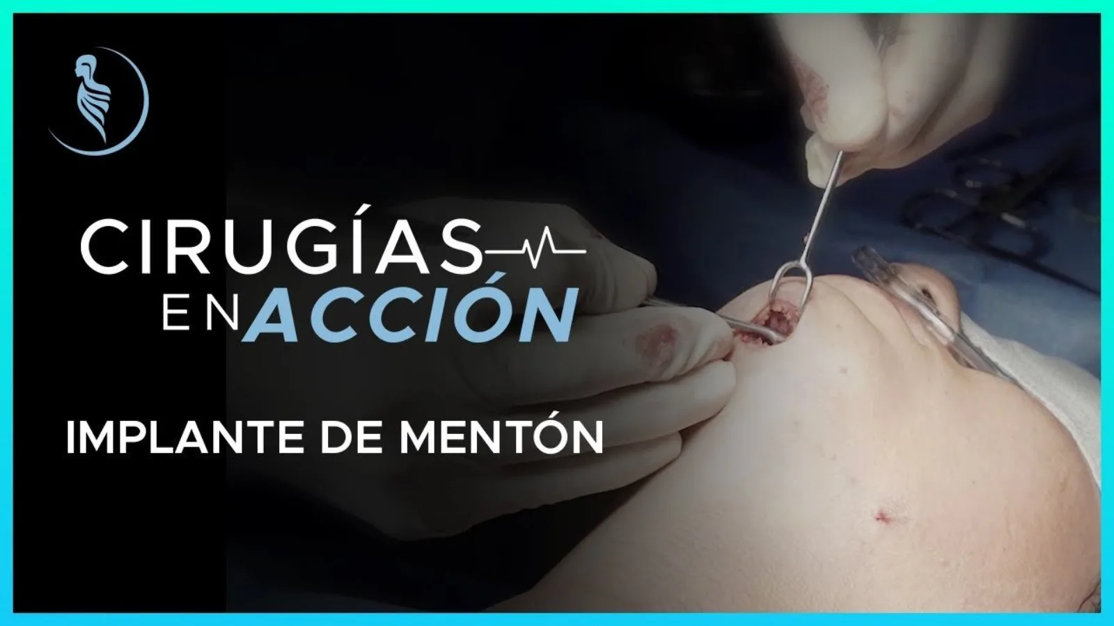 accion-7
