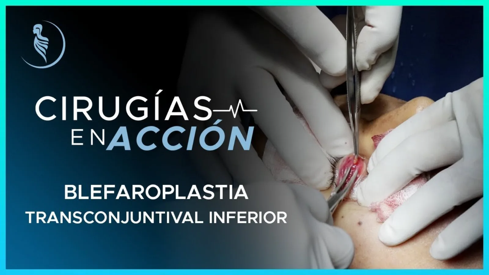 accion-8