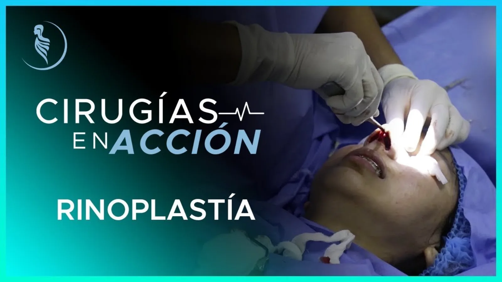 accion-9