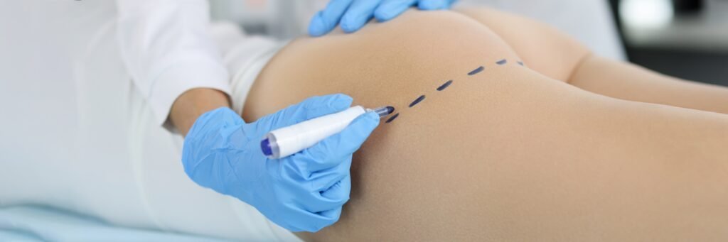 Doctor,Making,Preoperative,Marking,On,Patient,Buttocks,Closeup