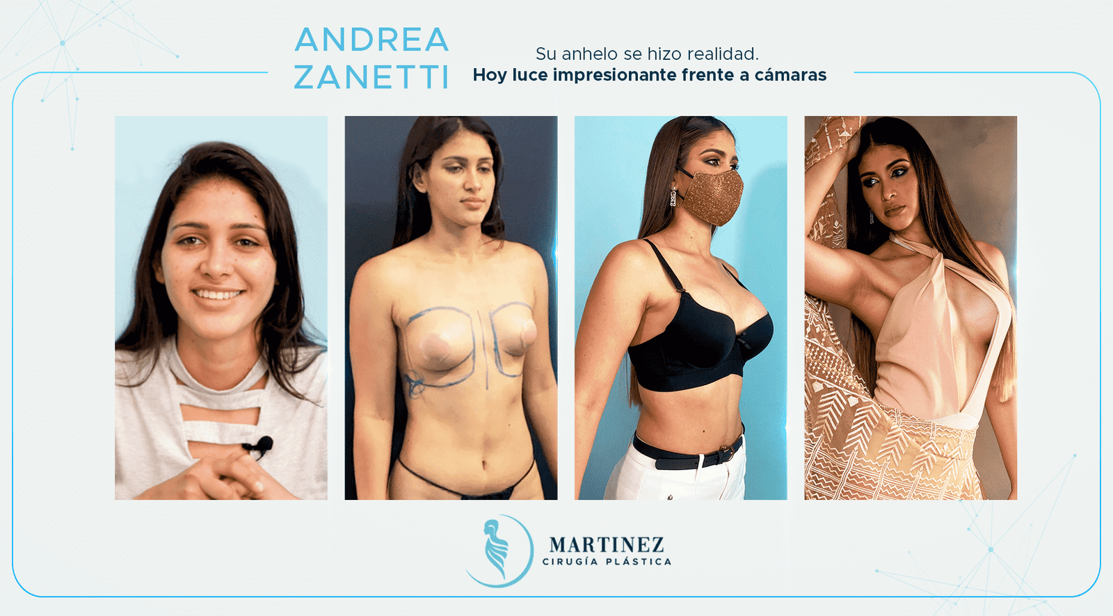 Antes y después — paciente Andrreazanetti
