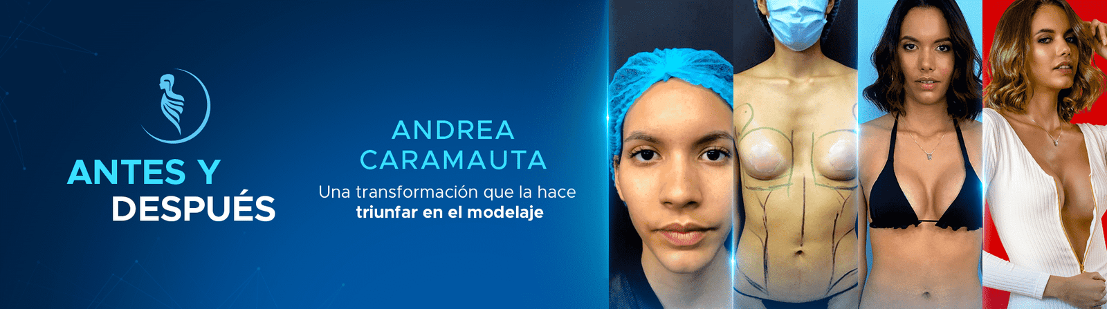 Antes y después — paciente Ansteddespuesandrea