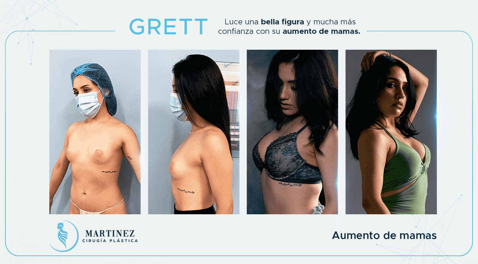 Antes y después — paciente Grett