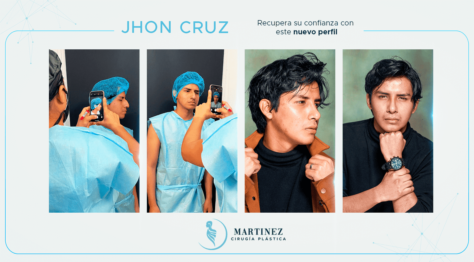 Antes y después — paciente Jhon