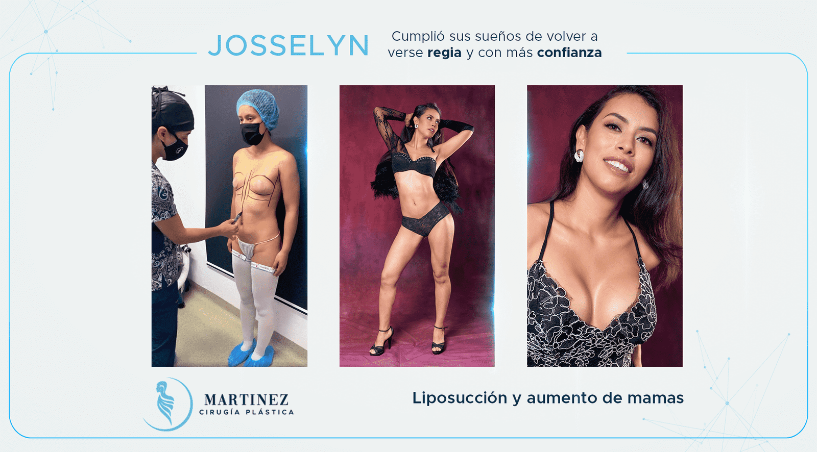 Antes y después — paciente Josselyn