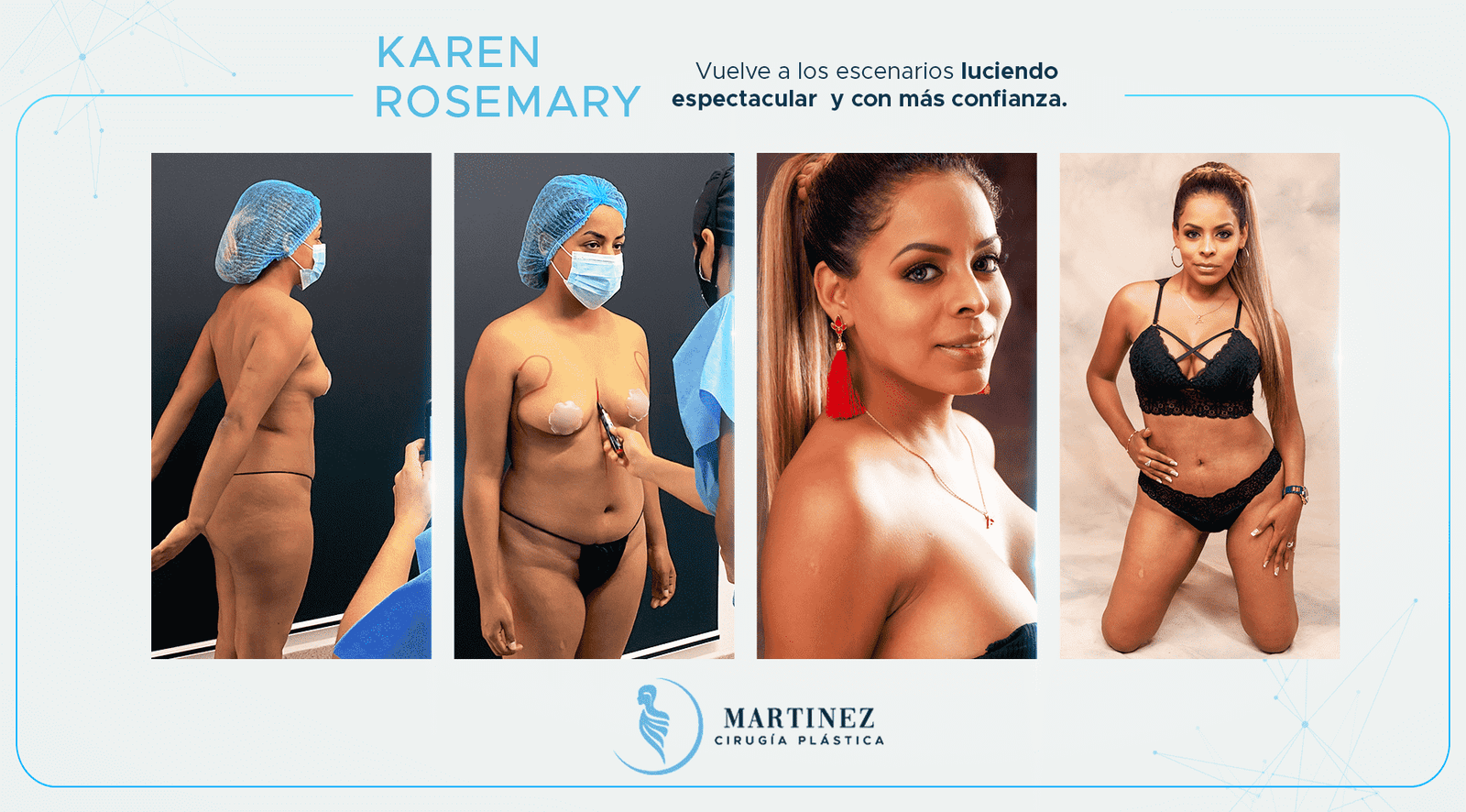 Antes y después — paciente Karenrose