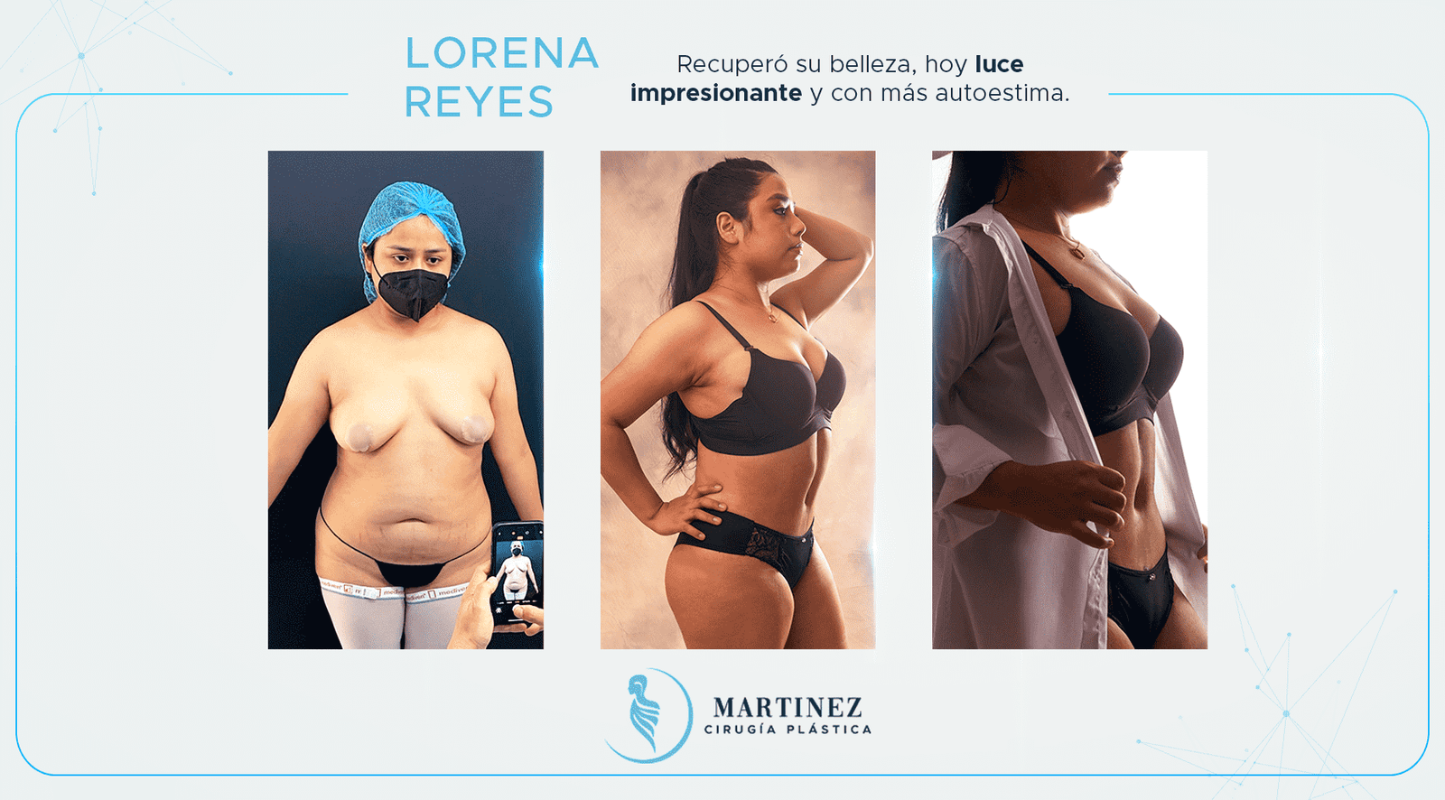 Antes y después — paciente Lorena