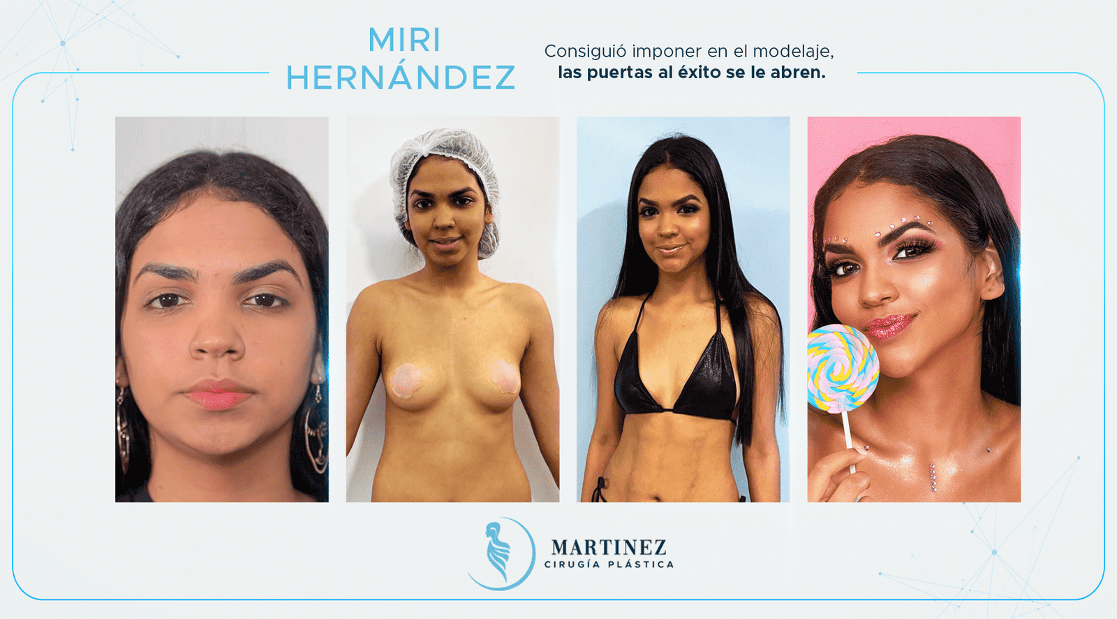 Antes y después — paciente Miri