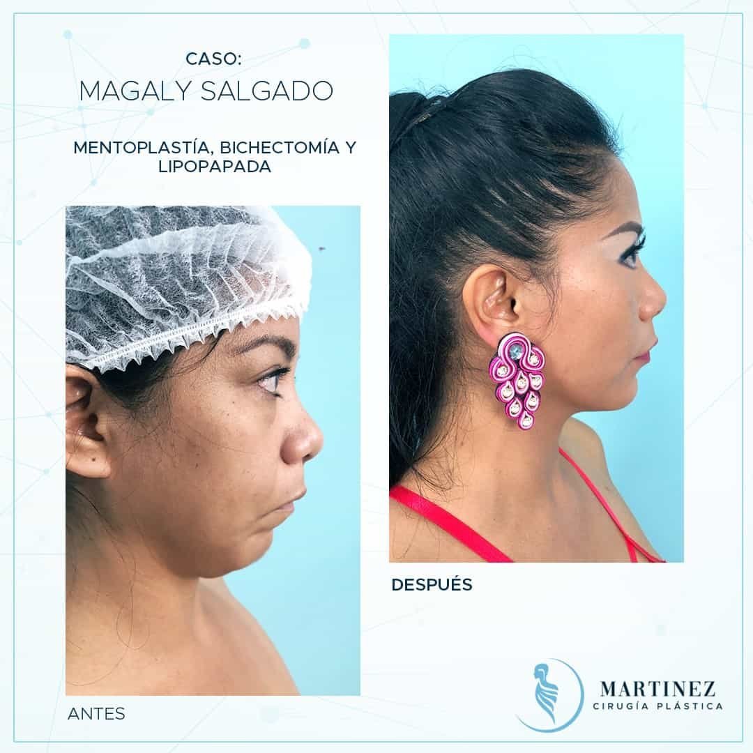 Caso real — Magaly