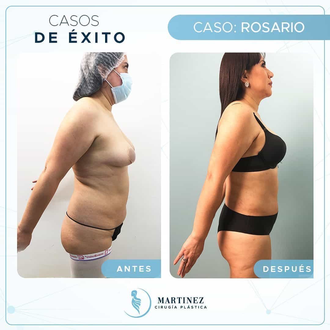 Caso real — Rosario