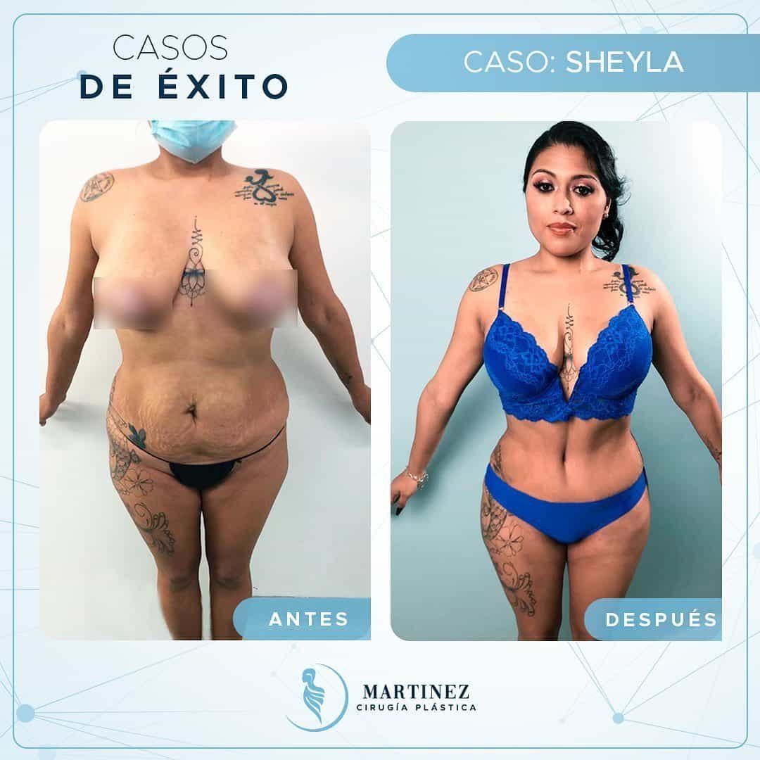 Caso real — Sheyla