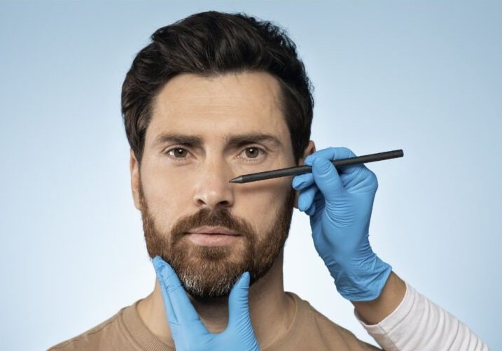 Rinoplastia para hombres