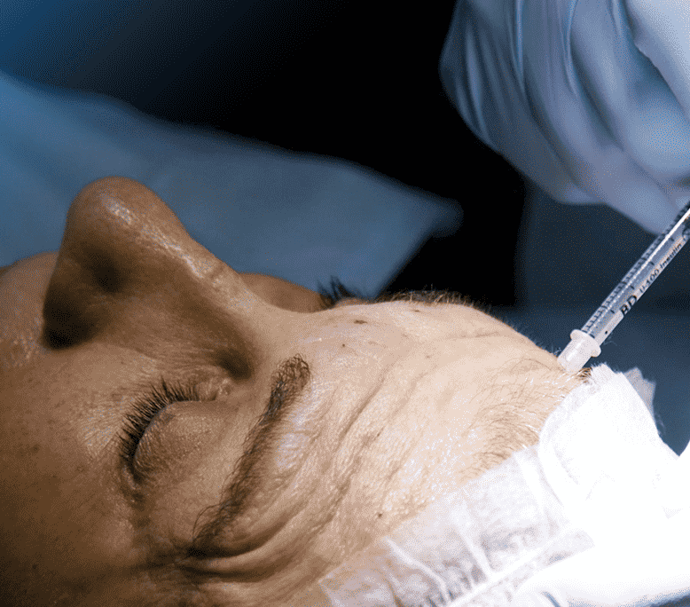 Toxina Botulínica (Botox)